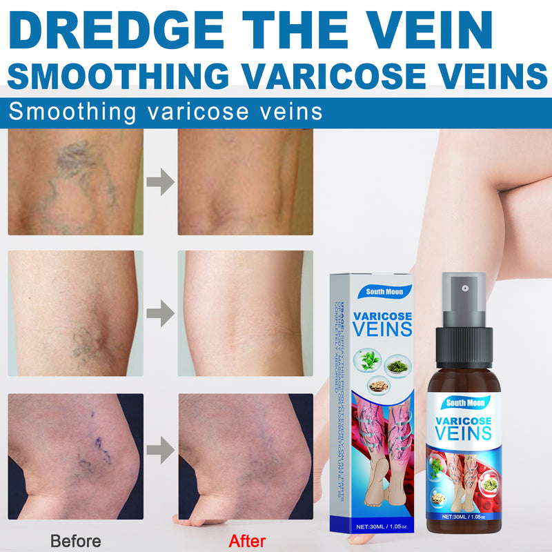 Venen-Spray Entlastung Qu Zhang Fuping Blutgefäß-Wölbung Glättendes Regenwurm-Beinmassage-Spray