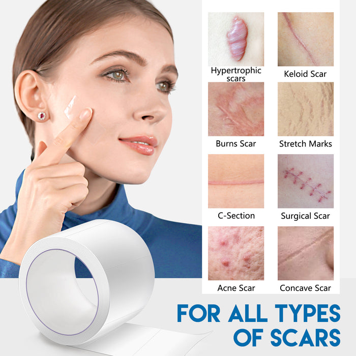 ELAIMEI Facial Invisible Scar Sticker Roll Self-adhesive Waterproof Breathable