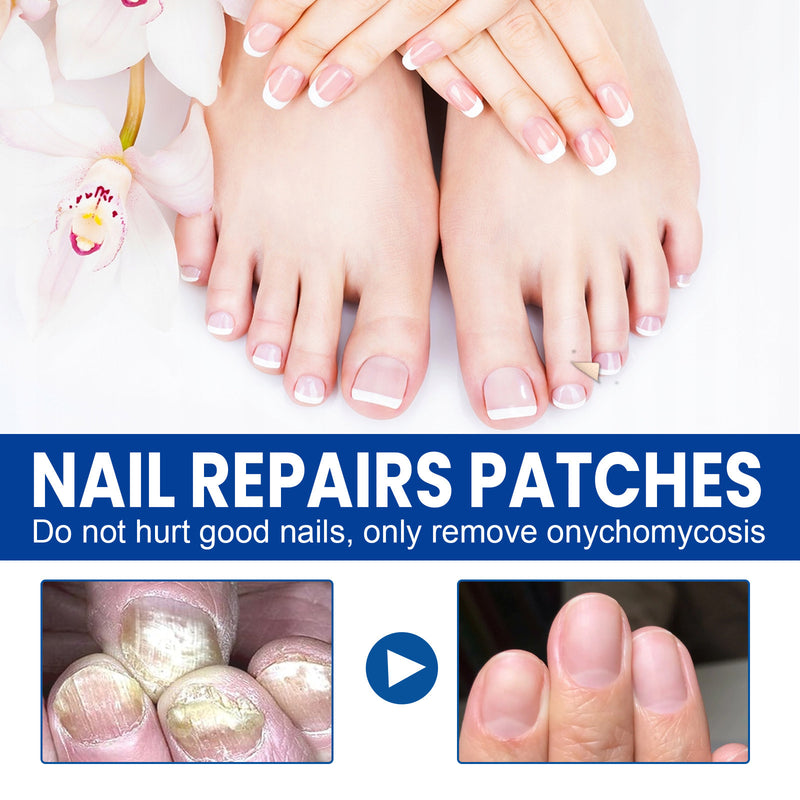 Nourishing And Brightening Nail Care Nail Polish Stickers