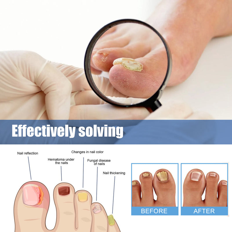 Nourishing And Brightening Nail Care Nail Polish Stickers
