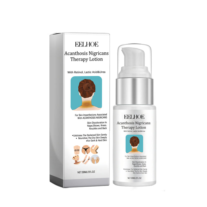 Acanthosis Nigricans Therapy Lotion
