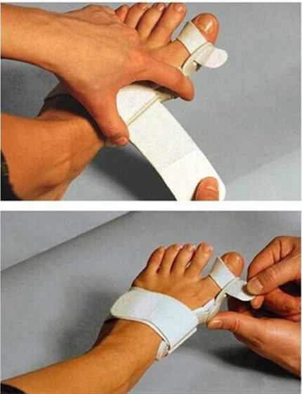 Hallux-Valgus-Korrektor mit Zehenspreizer